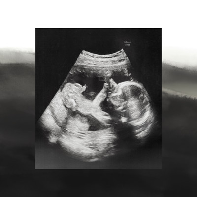 燈のジャケット写真