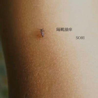 隔靴掻痒のジャケット写真