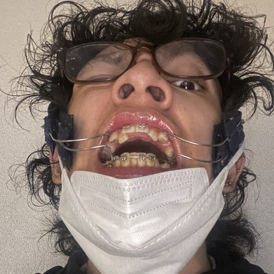 HOTEL Forest inn Kyle Front Cover