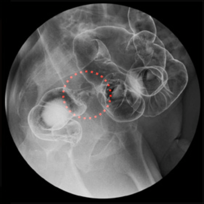 cancer (feat. KAFU) Front Cover