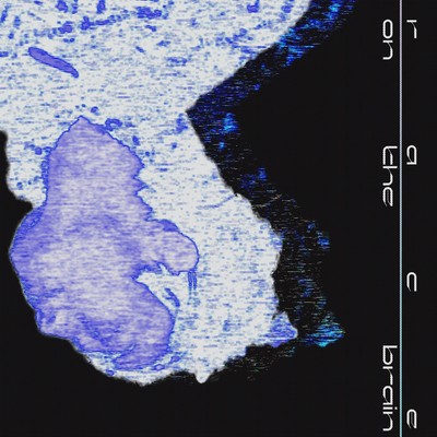 Race on the Brain Front Cover