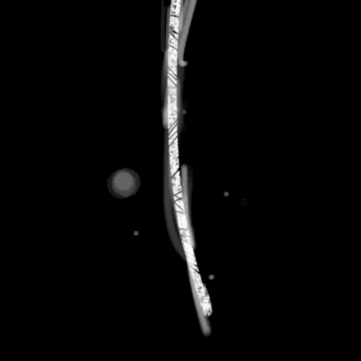 銀の糸のジャケット写真