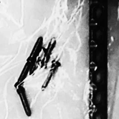 Rage On Stage Front Cover