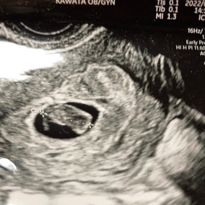 Badboyのジャケット写真