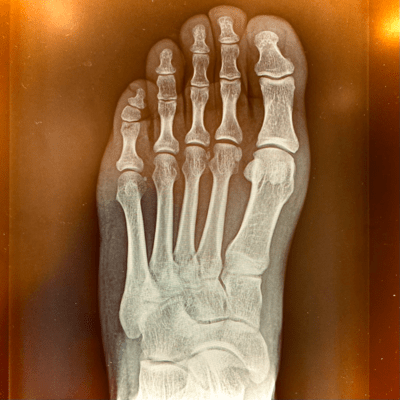 Punk Band You/LALALA Front Cover