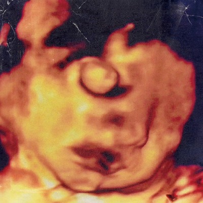 haruhiko Front Cover