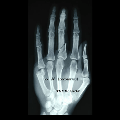 Be snapped my heart (2025 Remastered) Front Cover