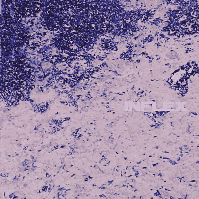 Inflex Front Cover