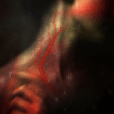 UNDRESSのジャケット写真