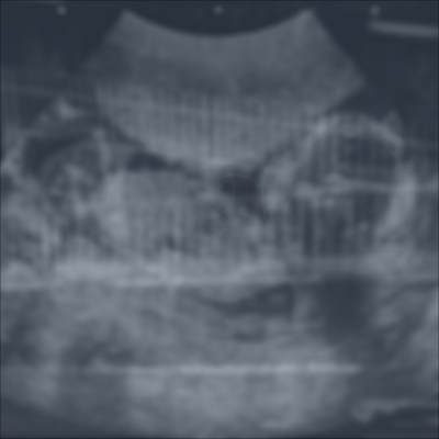 あだるとのジャケット写真