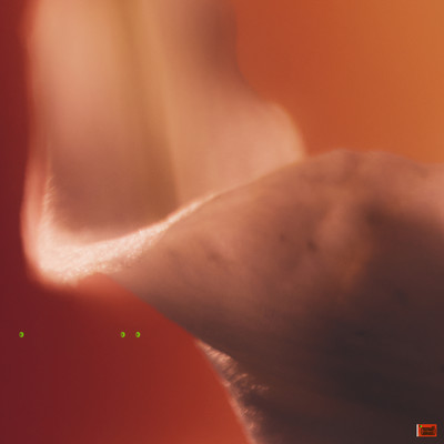 Helix Dreamsのジャケット写真