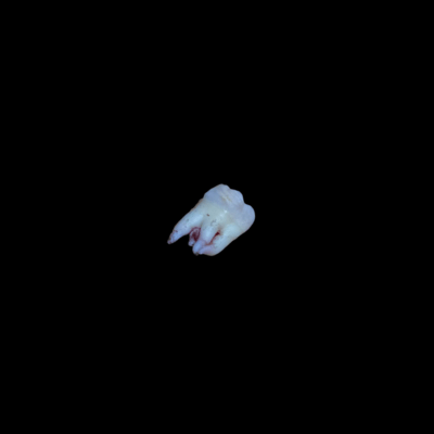Original Teeth Front Cover