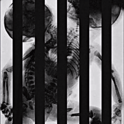 Dépaysement (feat. 初音ミク & ゲキヤク)のジャケット写真