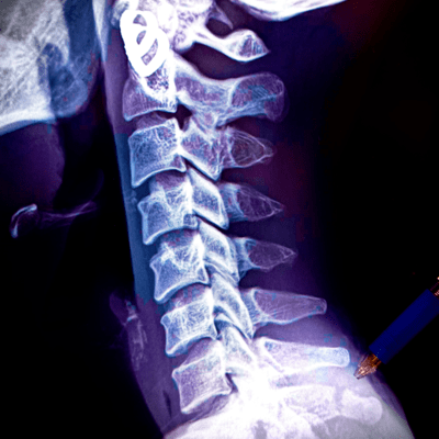 Do or Dieのジャケット写真