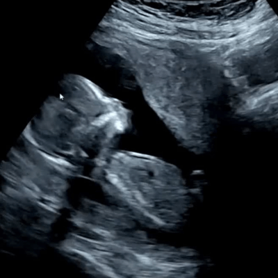 母になるのジャケット写真