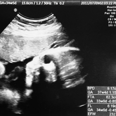 Oretu Niのジャケット写真