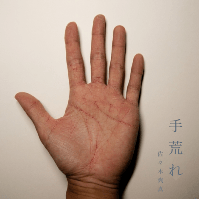 手荒れのジャケット写真