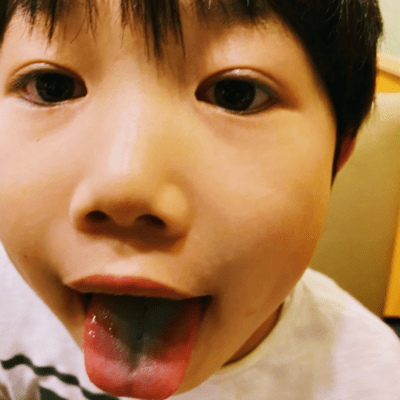 アレダメソレダメのジャケット写真