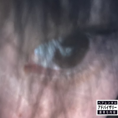 ALAS (cyberpsychosis version) Front Cover