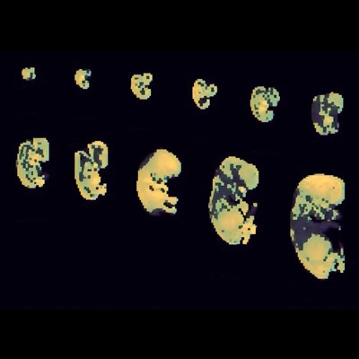 発生のジャケット写真